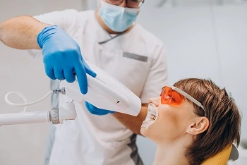 diş beyazlatma uygulaması (bleaching) diş beyazlatma fiyatları 2022