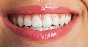 Diş Estetiği Porselen Lamina